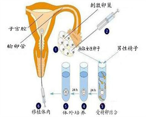 北京私人供卵供卵代孕,北京三代供卵代孕包男孩靠谱吗