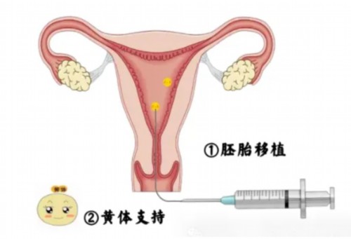 北京代怀试管中心,北京供卵试管中介,北京试管供卵机构