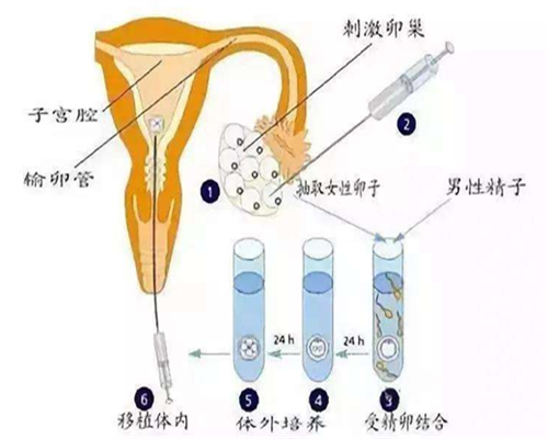 北京知名代怀网,北京生子试管费用详解