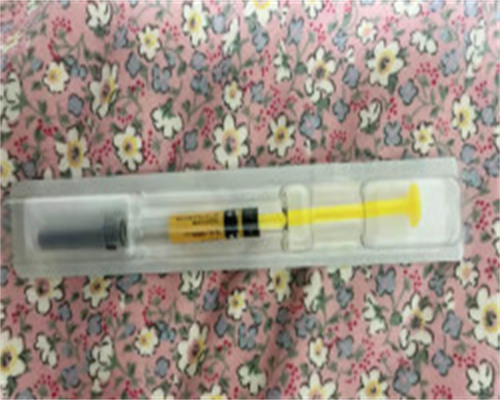 试管三部曲为你打开人生新篇章