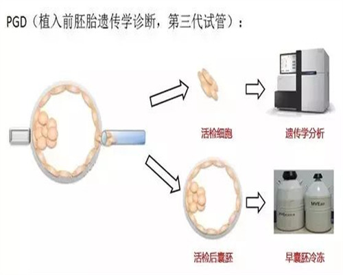 北京有偿代孕网,2026北京协和医院供卵试管多少钱？附北京供卵试管费用一览表