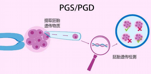 北京幸福代孕网,北京试管包男孩
