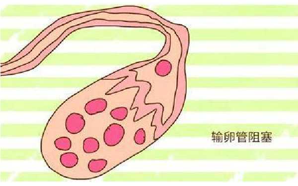 重庆有正规助孕中心吗 22022年重庆市可放心选择的供卵机构名单有7家 ‘四个月